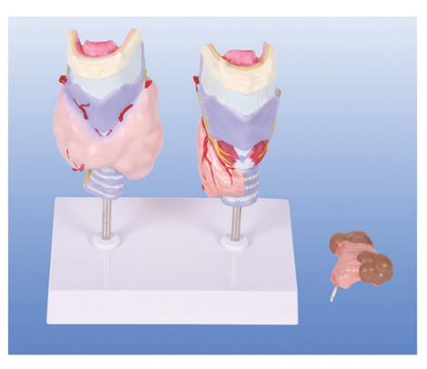 甲状腺病理模型